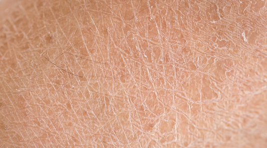 Moisturizing Cream