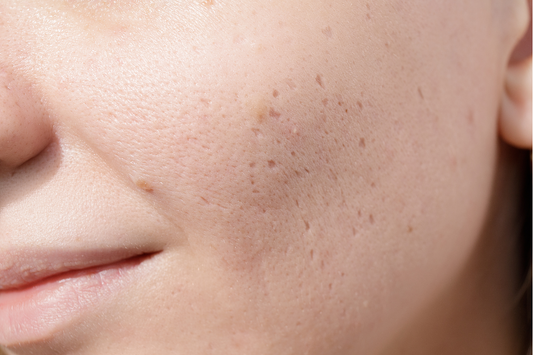 Derma Stamp