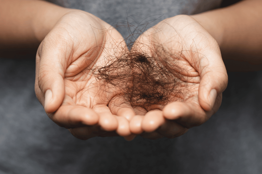 Hair Loss