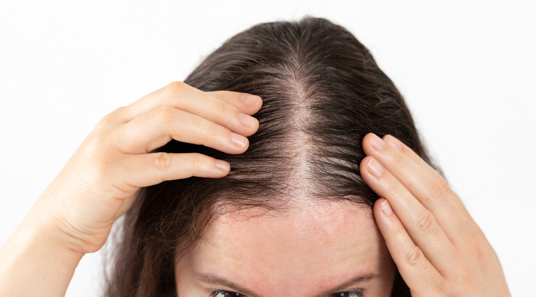 Woman parting her hair to show a thinning scalp at the hairline