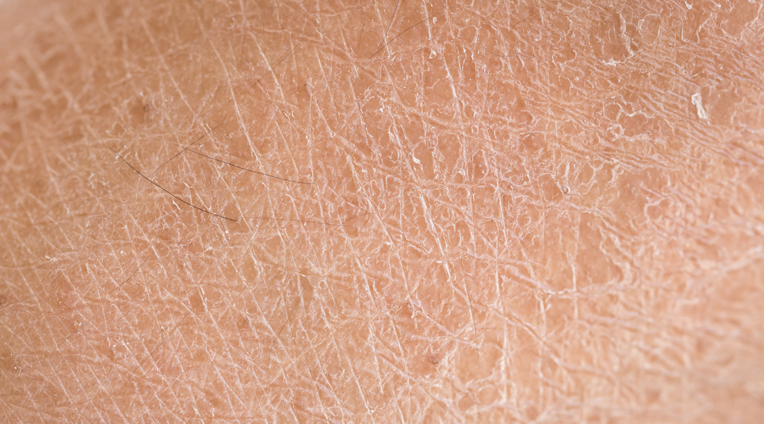 Moisturizing Cream